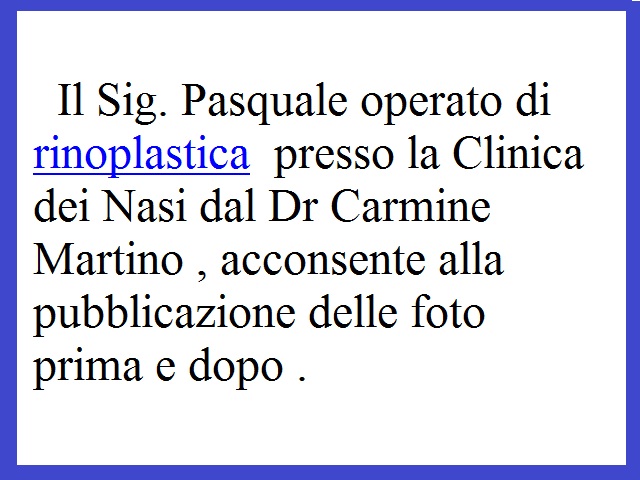La decolorazione di crema da liyerak